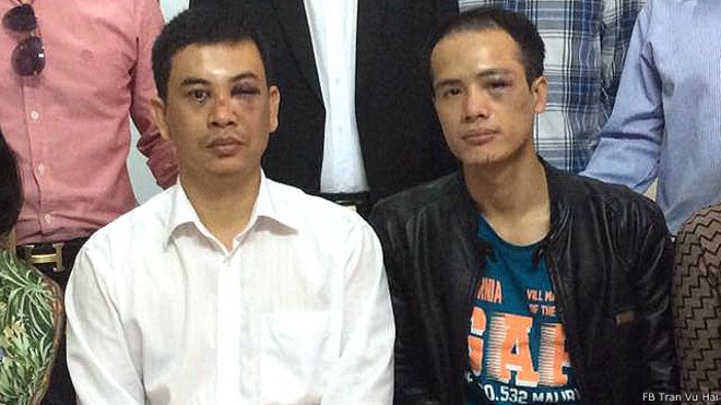 Liên đoàn Luật sư Việt Nam vừa có công văn đề nghị khởi tố vụ án hai luật sư Trần Thu Nam (trái) và Lê Văn Luân bị hành hung hôm 3/11/2015. Ảnh: FB Tran Vu Hai